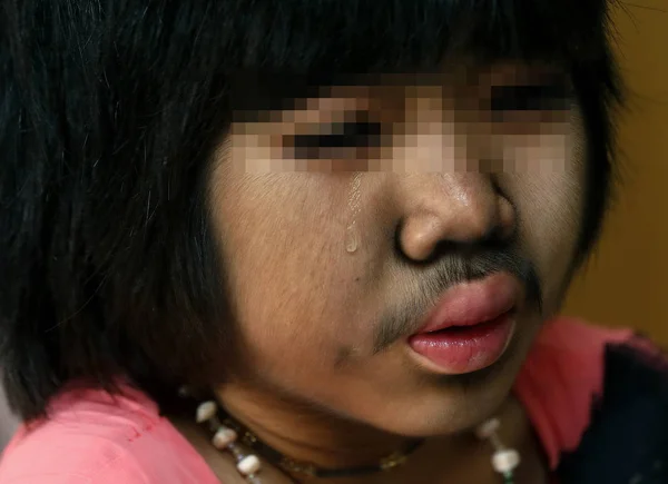 Молодая Китаянка Тин Тин Которой Лице Растет Сильная Борода Плачет — стоковое фото