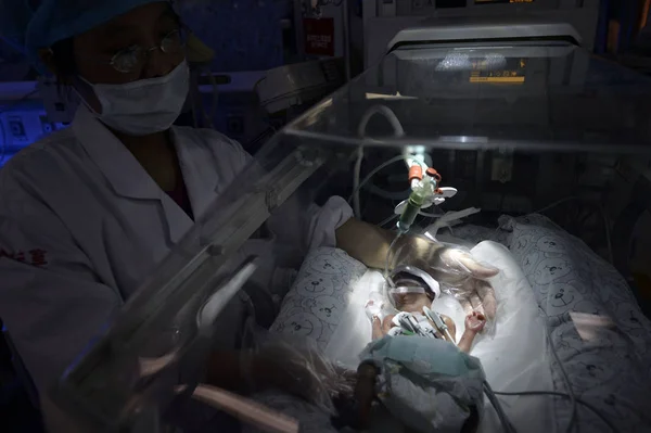 Chinese Doctor Takes Care China Tiniest Premature Baby Nicknamed Chopstick — Stock Photo, Image