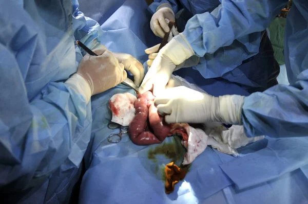 Injured Three Year Old Giant Panda Receives Operation Tangjiahe National — Stock Photo, Image