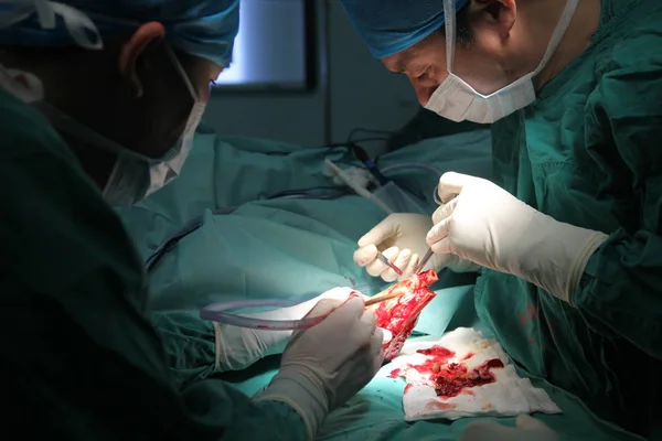 中国の医師は 長中国湖南省の中央南大学にある Xiangya 病院の外科手術中に 脚の動脈から血液供給を借りるために ワイス右手を左足首に取り付け — ストック写真