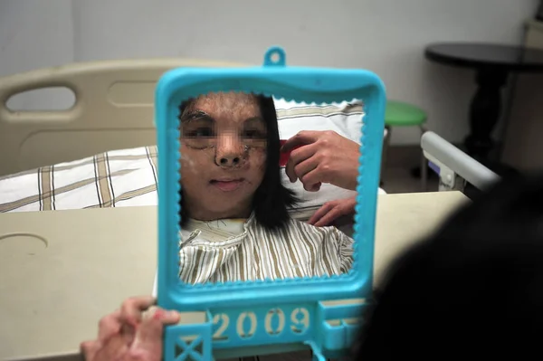 Jianmei Izquierda Niña Que Recibió Trasplante Cara Mira Espejo Hospital —  Fotos de Stock