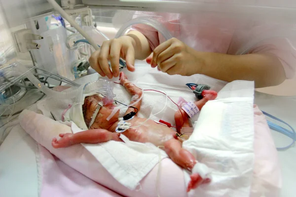 看護師は 2013年10月30日 中国中央省湖南省長沙市のXiangya病院で Icuのインキュベーター内で治療を受けている未熟な女性の乳児の世話をします — ストック写真