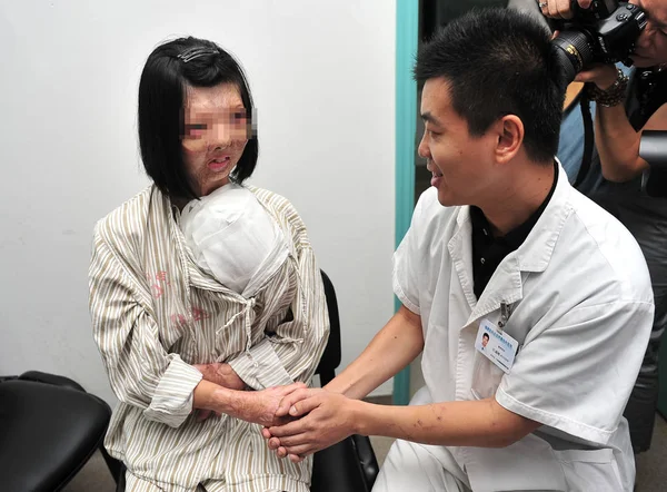 Jianmei Vlevo Dívka Která Podstoupila Transplantaci Obličeje Potřásá Rukou Svým — Stock fotografie