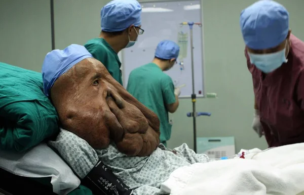 Médicos Chinos Examinan Huang Chuncai Que Sufre Enormes Tumores Cara —  Fotos de Stock