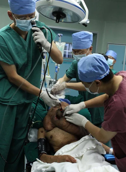 2013年12月25日 中国医生为脸部肿瘤巨大的黄春才在中国广东省南部广州市富达肿瘤医院做手术做准备 — 图库照片
