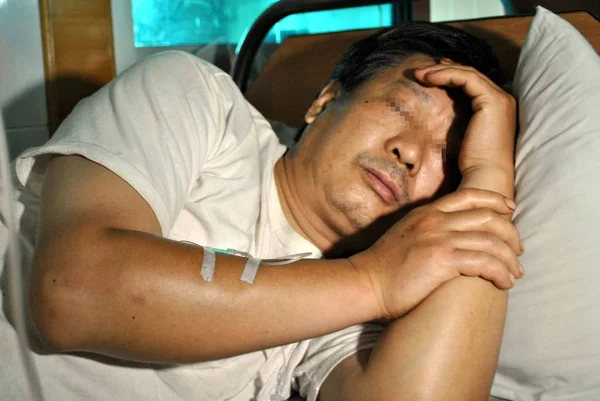 Китайский Трудовой Мигрант Фамилии Фэй Пенис Отрезан Получает Инфузию Больнице — стоковое фото