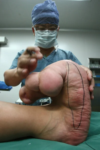 Médico Marca Los Pies Grandes Del Joven Chino Xiao Men —  Fotos de Stock