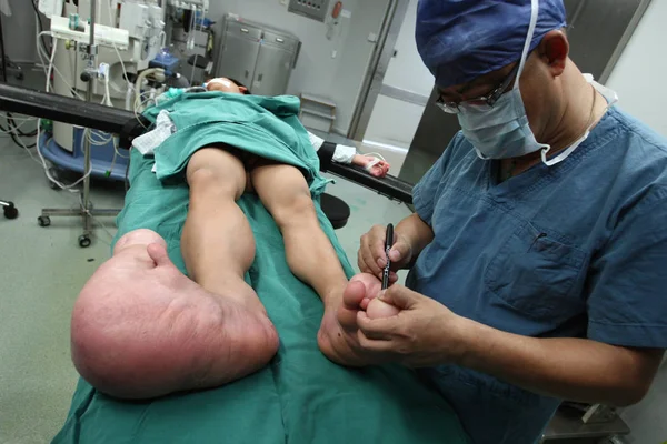 Doctor Marks Big Feet Young Chinese Boy Xiao Men Surgery — Stock Photo, Image