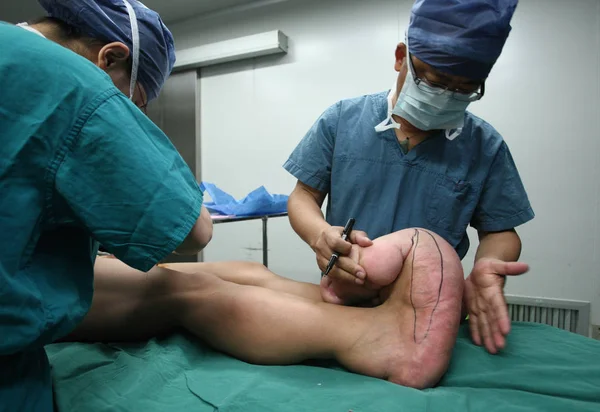 Ein Arzt Markiert Die Großen Füße Junger Chinesischer Jungen Vor — Stockfoto