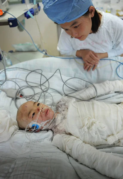 Infermiera Prende Cura Della Bambina Sette Anni Gravemente Bruciata Lin — Foto Stock