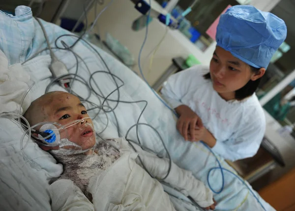 Infermiera Prende Cura Della Bambina Sette Anni Gravemente Bruciata Lin — Foto Stock