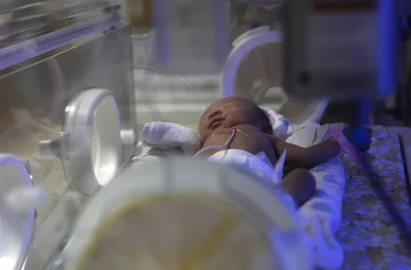 Bebê Abandonado Retratado Uma Unidade Terapia Intensiva Neonatal Centro Atendimento — Fotografia de Stock