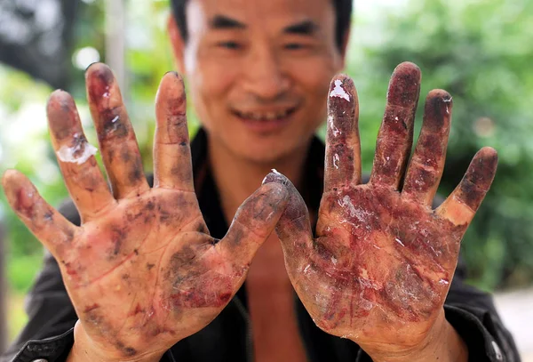 Китайский Фермер Маньшэн Показывает Травмы Руках Перед Первым Испытательным Полётом — стоковое фото