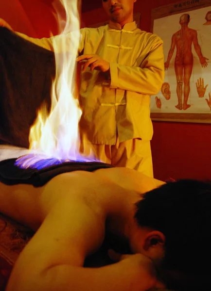 2009年1月14日 一名中国男子在浙江省嘉兴市当地中医医院接受医疗火灾治疗 — 图库照片