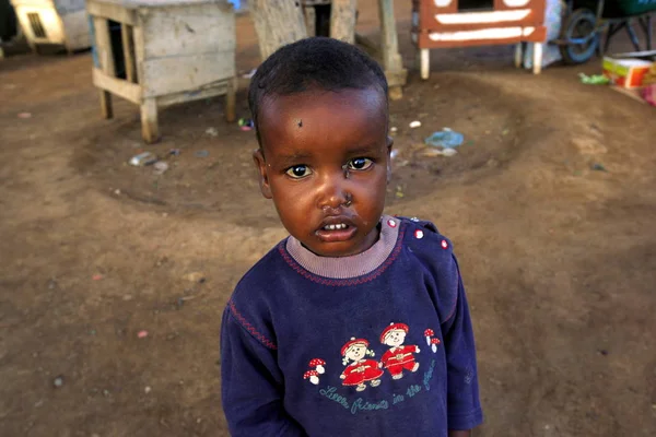 Somali Child Whose Face Bit Flies Poses Photos Somalia January — Stock Photo, Image