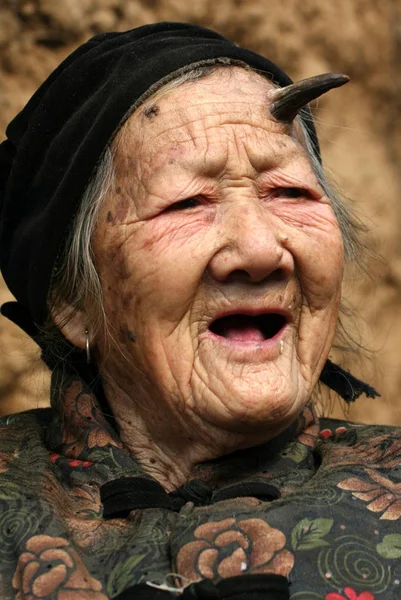 101岁的张瑞芳 额头长着一个角 在河南省平顶山市芦山县林楼村摆姿势拍照 2010年3月7日 — 图库照片