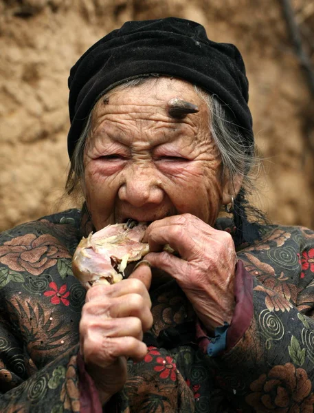 Zhang Ruifang 101 Anos Cuja Testa Cresce Chifre Come Frango — Fotografia de Stock