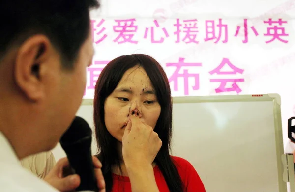 Čínské Korejské Plastická Chirurgie Odborníků Zkoumat Beznosý Žena 21Rok Starý — Stock fotografie