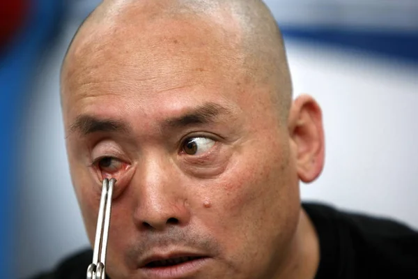 Chinese Stuntman Dong Changsheng Puts Hook His Eyelid Preparation Pulling — Stock Photo, Image