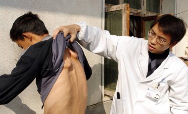 A Chinese doctor examines 19-year-old Wang Jianxue who is the son of He Minggui and suffers from PMD (progressive muscular dystrophy) in Hefan village, Xinzhou district, Wuhan city, central Chinas Hubei province, 16 December 2008 clipart