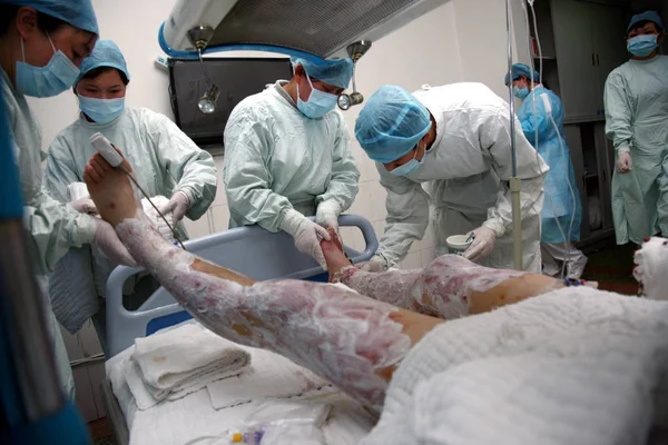 Kinesiska Läkare Behandla Man Bränns Gräs Bevuxen Brand Får Medicinsk — Stockfoto