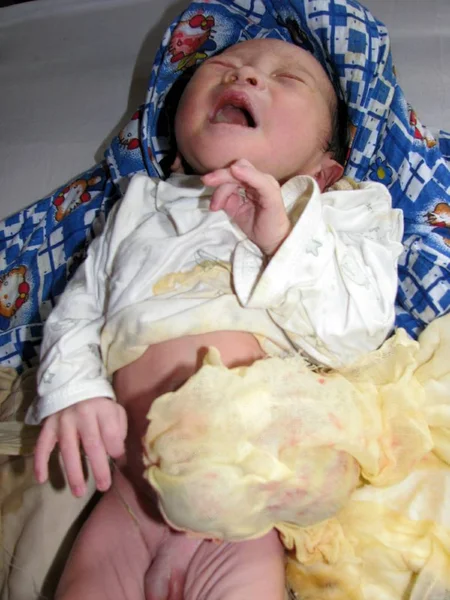 Niño Recién Nacido Cuyo Hígado Crece Fuera Del Abdomen Hospital —  Fotos de Stock