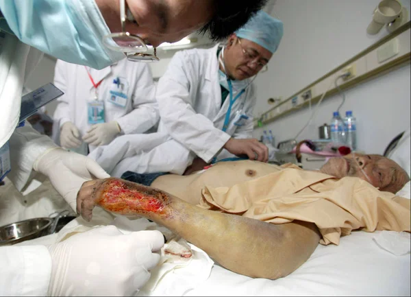 Chinese Doctors Examine Old Man Who Injured Massive Earthquake Sichuan — Stock Photo, Image