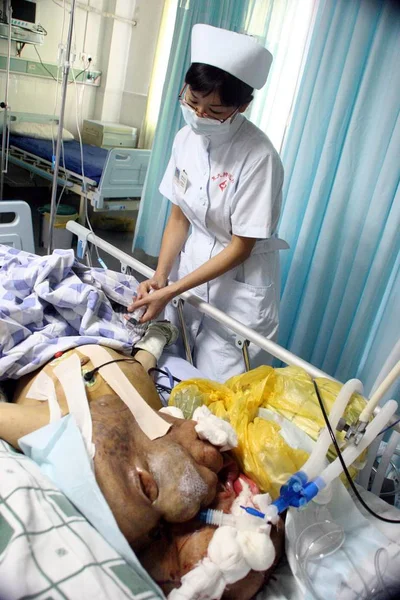 Kinesisk Sjuksköterska Deltar Huang Chuncai Som Lider Enorma Tumör Ansiktet — Stockfoto