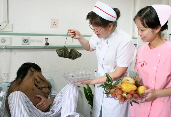 พยาบาลจ าผลไม และเก ยวข าวเหน ยวมาท Huang Chuncai ทรมานจากเน องอกขนาดใหญ — ภาพถ่ายสต็อก