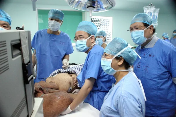 2007年7月24日 在中国南方广东省广州福达肿瘤医院进行切除大面积肿瘤的手术中 中国医生对面部肿瘤巨大的黄春才进行了检查 — 图库照片