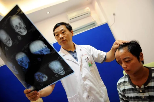 Chinese Doctor Wang Peisen Left Looks Computer Generated Rendition Skull — Stock Photo, Image