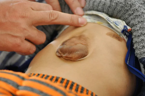 Doctor Checks Protruding Heart Year Old Kid Zhang Weiyuan Shengjing — Stock Photo, Image