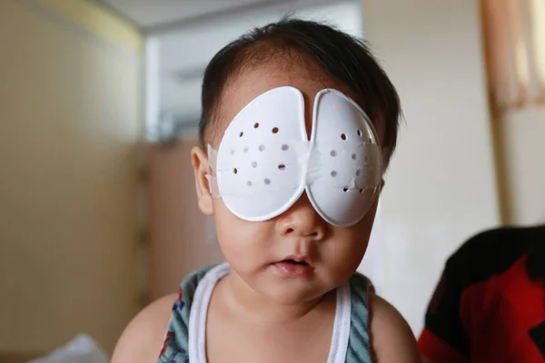 Babies Undergoing Eye Surgery Surgery Must Wear Eye Protection — Stock Photo, Image