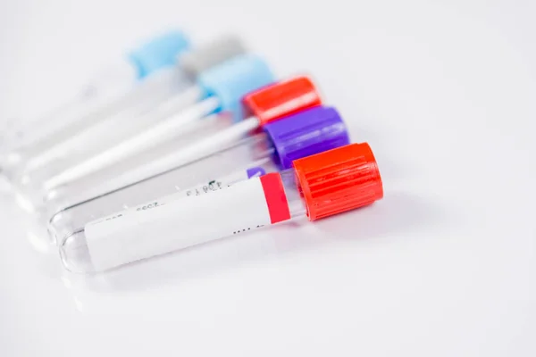 Έξι μπουκάλια για τα δείγματα που χρησιμοποιούνται σε νοσοκομεία ή φάρμακο για δείγματα αίματος σε εργαστήριο, σε λευκό φόντο — Φωτογραφία Αρχείου
