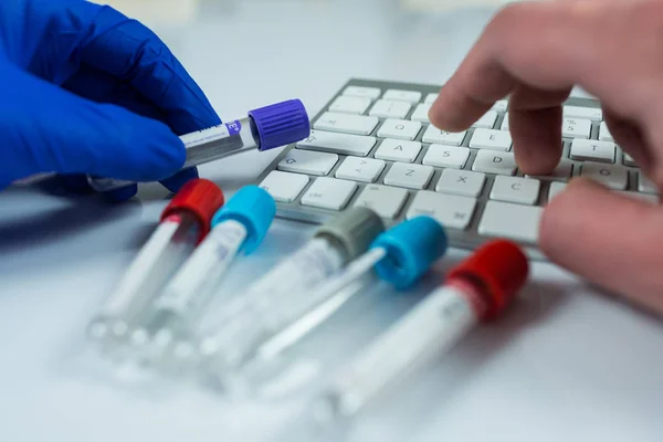 Χέρι γάντια μπλε κρατώντας μπουκάλια για τα δείγματα που χρησιμοποιούνται σε νοσοκομεία ή φάρμακο για τα δείγματα αίματος σε ένα εργαστήριο και τη δακτυλογράφηση στο πληκτρολόγιο του υπολογιστή σε άσπρο φόντο — Φωτογραφία Αρχείου