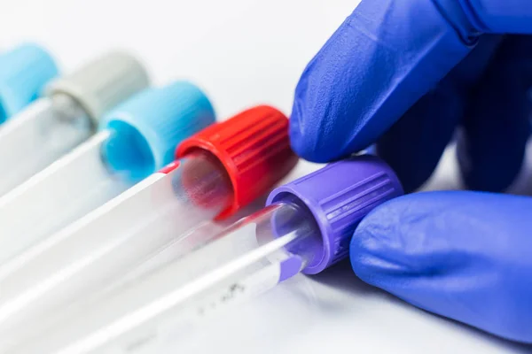 Χέρι γάντια μπλε κρατώντας μπουκάλια για τα δείγματα που χρησιμοποιούνται σε νοσοκομεία ή φάρμακο για δείγματα αίματος σε εργαστήριο, σε λευκό φόντο — Φωτογραφία Αρχείου