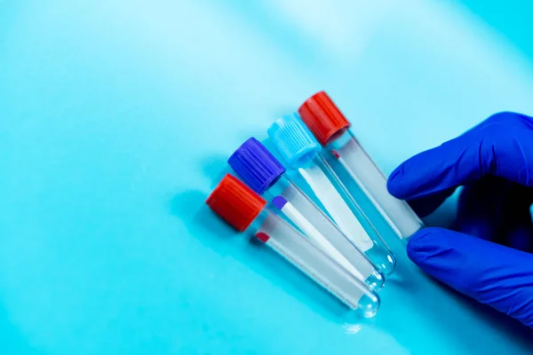 Χέρια φορώντας μπλε γάντια κρατώντας φιάλες για δείγματα που χρησιμοποιούνται σε νοσοκομεία ή φάρμακα για δείγματα αίματος σε εργαστήριο σε μπλε φόντο — Φωτογραφία Αρχείου