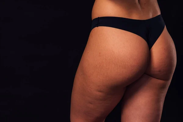 Problem of cellulitis. sports ass on a black background — Stock Photo, Image
