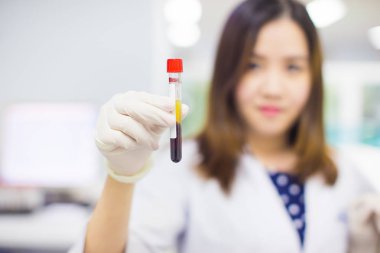 tıbbi teknolog laboratuvarda çalışıyor, kan tüpünü analiz : Hastane, sağlık, klinik, doktor, hasta, bilim, genetikçi ve araştırma kavramı için resim.