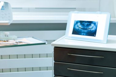 Diş hekiminde film aydınlatma üzerine röntgen.