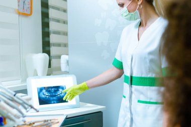 Kadın dişçi, genç kız hastasına röntgen ve çene röntgenini gösteriyor. Diş hekimliği. 