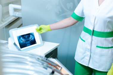 Kadın dişçi, film aydınlatıcısı (izleyici) kullanarak çene ve diş röntgenini gösteriyor. Diş hekimliği. 