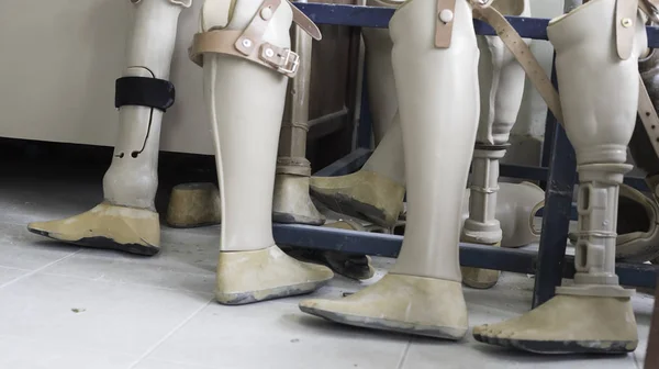 Konstgjord ben av medicinsk utrustning plast treatmenta — Stockfoto