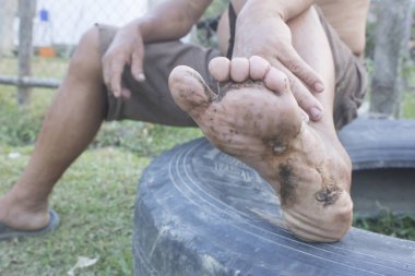 Sol bacağında diyabet, kirli yarası olan ve fakir insanlar. 