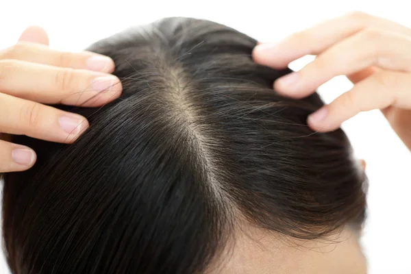 Mujer Haciendo Masaje Cuero Cabelludo — Foto de Stock