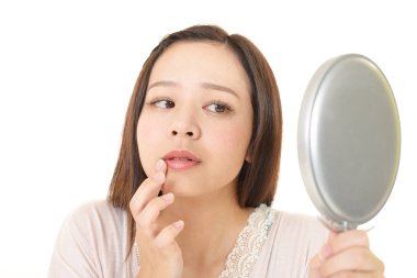 Cilt sorunları olan genç bir kadın.