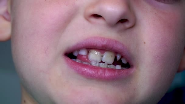 Зубы младенцев шатаются — стоковое видео