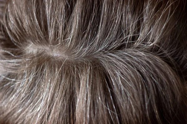 Going Gray Young Woman Shows Her Gray Hair Roots Selective — Stock Photo, Image