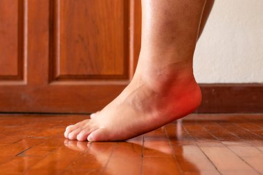Female foot heel pain or plantar fasciitis. Health care concept. clipart