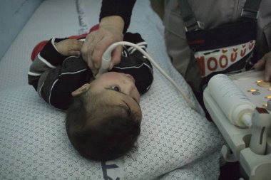 Khan yunis, Gazze Şeridi/Filistin-Şubat 22 2015: bir Italyan kalp cerrahisi ekibi ziyaretler ve kalp ile acilen çalışmak için çocukları seçer